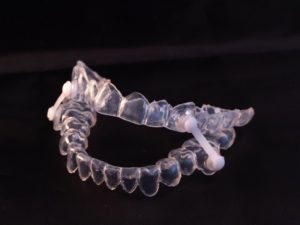 an image of a clear oral appliance used to treat sleep apnea